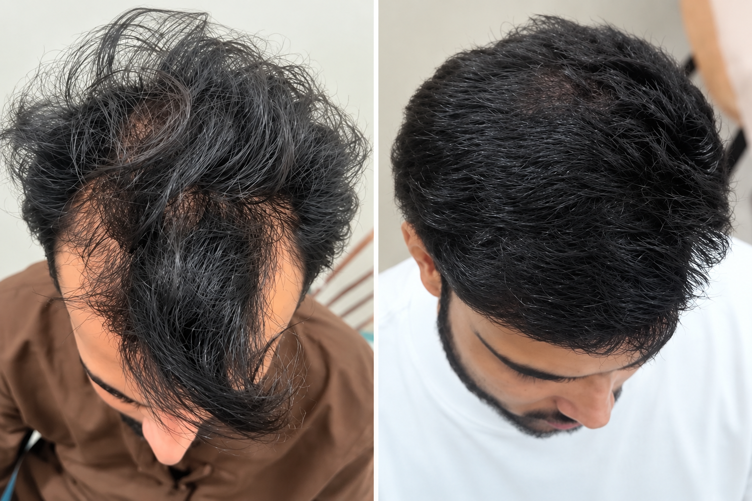 Skin Brightening Before and After